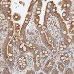 TMPPE Antibody in Immunohistochemistry (IHC)