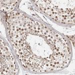 ZNF318 Polyclonal Antibody