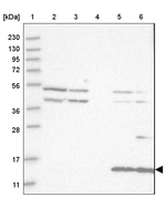 CYB561D1 Antibody in Western Blot (WB)