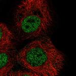 ZNF318 Polyclonal Antibody