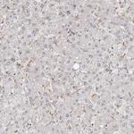 ZNF318 Antibody in Immunohistochemistry (Paraffin) (IHC (P))