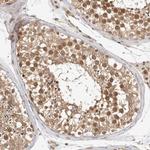 ZNF318 Antibody in Immunohistochemistry (Paraffin) (IHC (P))