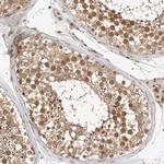 ZNF318 Antibody in Immunohistochemistry (IHC)