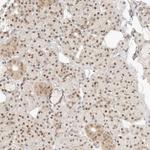 ASCL3 Antibody in Immunohistochemistry (Paraffin) (IHC (P))