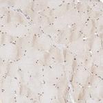 ASCL3 Antibody in Immunohistochemistry (Paraffin) (IHC (P))