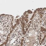ASTN2 Antibody in Immunohistochemistry (Paraffin) (IHC (P))