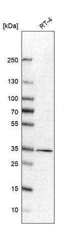 PPP1R3C Antibody in Western Blot (WB)