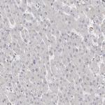 VANGL2 Antibody in Immunohistochemistry (Paraffin) (IHC (P))