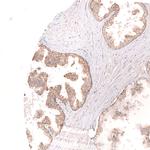 VANGL2 Antibody in Immunohistochemistry (Paraffin) (IHC (P))