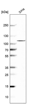 OTUD7B Antibody in Western Blot (WB)