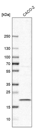 TMEM199 Antibody in Western Blot (WB)
