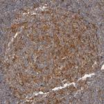 TUBD1 Antibody in Immunohistochemistry (Paraffin) (IHC (P))
