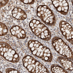 TUBD1 Antibody in Immunohistochemistry (Paraffin) (IHC (P))
