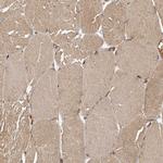 TUBD1 Antibody in Immunohistochemistry (Paraffin) (IHC (P))