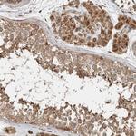 TUBD1 Antibody in Immunohistochemistry (Paraffin) (IHC (P))