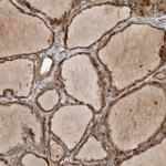 TUBD1 Antibody in Immunohistochemistry (Paraffin) (IHC (P))