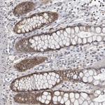 PDCL3 Antibody in Immunohistochemistry (Paraffin) (IHC (P))