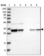 PDCL3 Antibody in Western Blot (WB)
