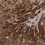 PDCD10 Polyclonal Antibody