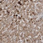 SCP2 Polyclonal Antibody