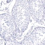 EYS Antibody in Immunohistochemistry (Paraffin) (IHC (P))