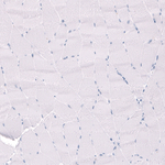 EYS Antibody in Immunohistochemistry (Paraffin) (IHC (P))