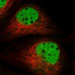 ADPRHL2 Polyclonal Antibody