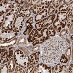 C1orf109 Polyclonal Antibody