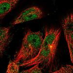 TSEN2 Antibody in Immunocytochemistry (ICC/IF)