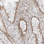TSEN2 Antibody in Immunohistochemistry (Paraffin) (IHC (P))