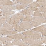 TSEN2 Antibody in Immunohistochemistry (Paraffin) (IHC (P))