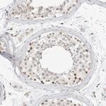 TSEN2 Antibody in Immunohistochemistry (Paraffin) (IHC (P))