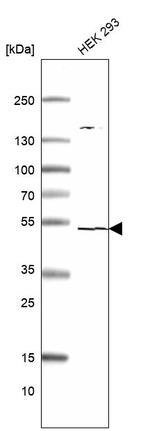 TSEN2 Antibody in Western Blot (WB)
