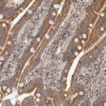 MTFR1L Polyclonal Antibody