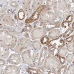 MTFR1L Antibody in Immunohistochemistry (IHC)