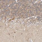 TSEN2 Polyclonal Antibody