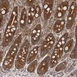 C1orf109 Antibody in Immunohistochemistry (Paraffin) (IHC (P))