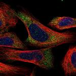 C1orf109 Polyclonal Antibody