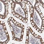 MTFR1L Antibody in Immunohistochemistry (IHC)