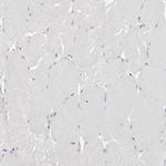 Tenascin R Antibody in Immunohistochemistry (Paraffin) (IHC (P))