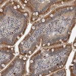 SCP2 Antibody in Immunohistochemistry (Paraffin) (IHC (P))