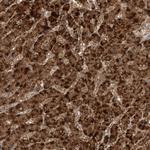 SCP2 Antibody in Immunohistochemistry (Paraffin) (IHC (P))
