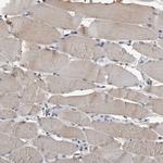 SCP2 Antibody in Immunohistochemistry (Paraffin) (IHC (P))