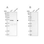 SCP2 Antibody in Western Blot (WB)