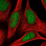 ADPRHL2 Polyclonal Antibody