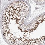 RALGPS2 Polyclonal Antibody