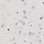 SPATA20 Antibody in Immunohistochemistry (IHC)