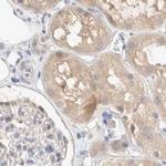 SPATA20 Antibody in Immunohistochemistry (IHC)