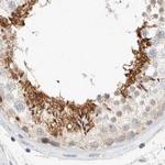 SPATA20 Antibody in Immunohistochemistry (IHC)