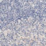 SPATA20 Antibody in Immunohistochemistry (IHC)